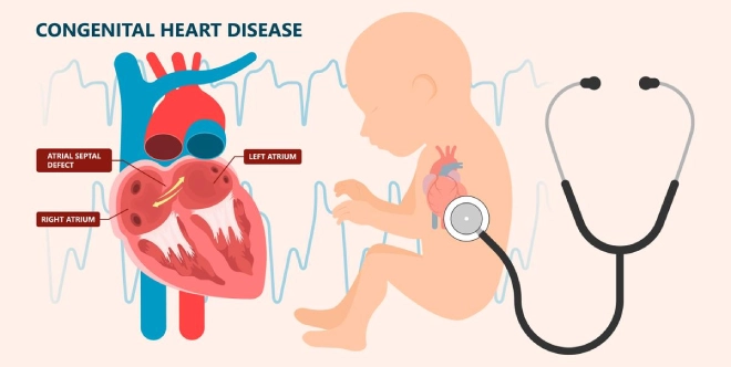 Expert heart care for atrial septal defect – Children's Health