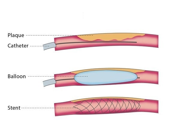 About Us Cardiomet